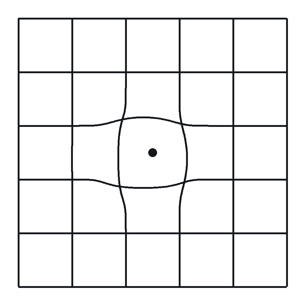 Amsler grid as it may appear with wet AMD: lines appear wavy and bent near the center