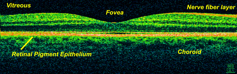 Optical coherence tomography (OCT) cross-section scan of a human retina showing its layered structure